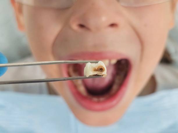 Best Walk-In Emergency Dental Services in Burton, OH